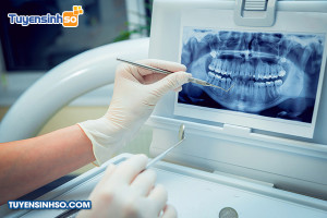 Ngành Kỹ thuật phục hình răng